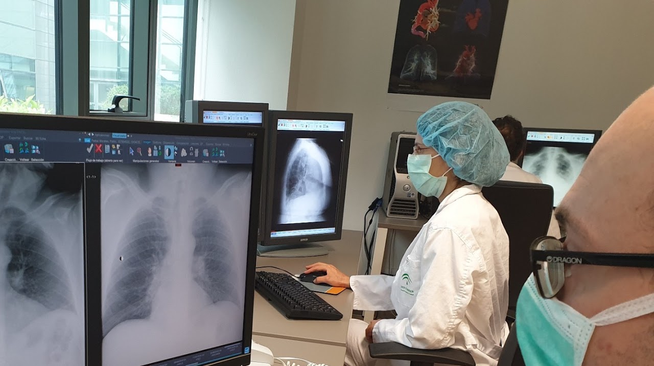 Radiografías de pacientes afectados por el covid19